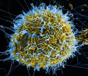 Colorized scanning electron micrograph of filament-like Ebola virus particles, in blue, budding from a chronically infected kidney Vero E6 cell, in yellow-green.