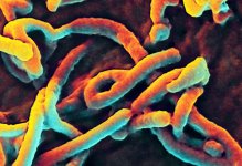 Scanning electron micrograph of an Ebola virus budding from the surface of a Vero cell from the African green monkey kidney epithelial cell line